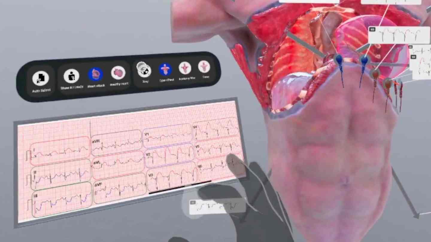 Meta Quest 游戏《了解心脏病》Understanding Heart Attack
