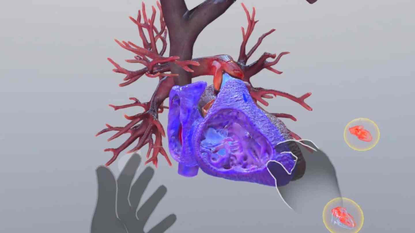 Meta Quest 游戏《了解心脏病》Understanding Heart Attack