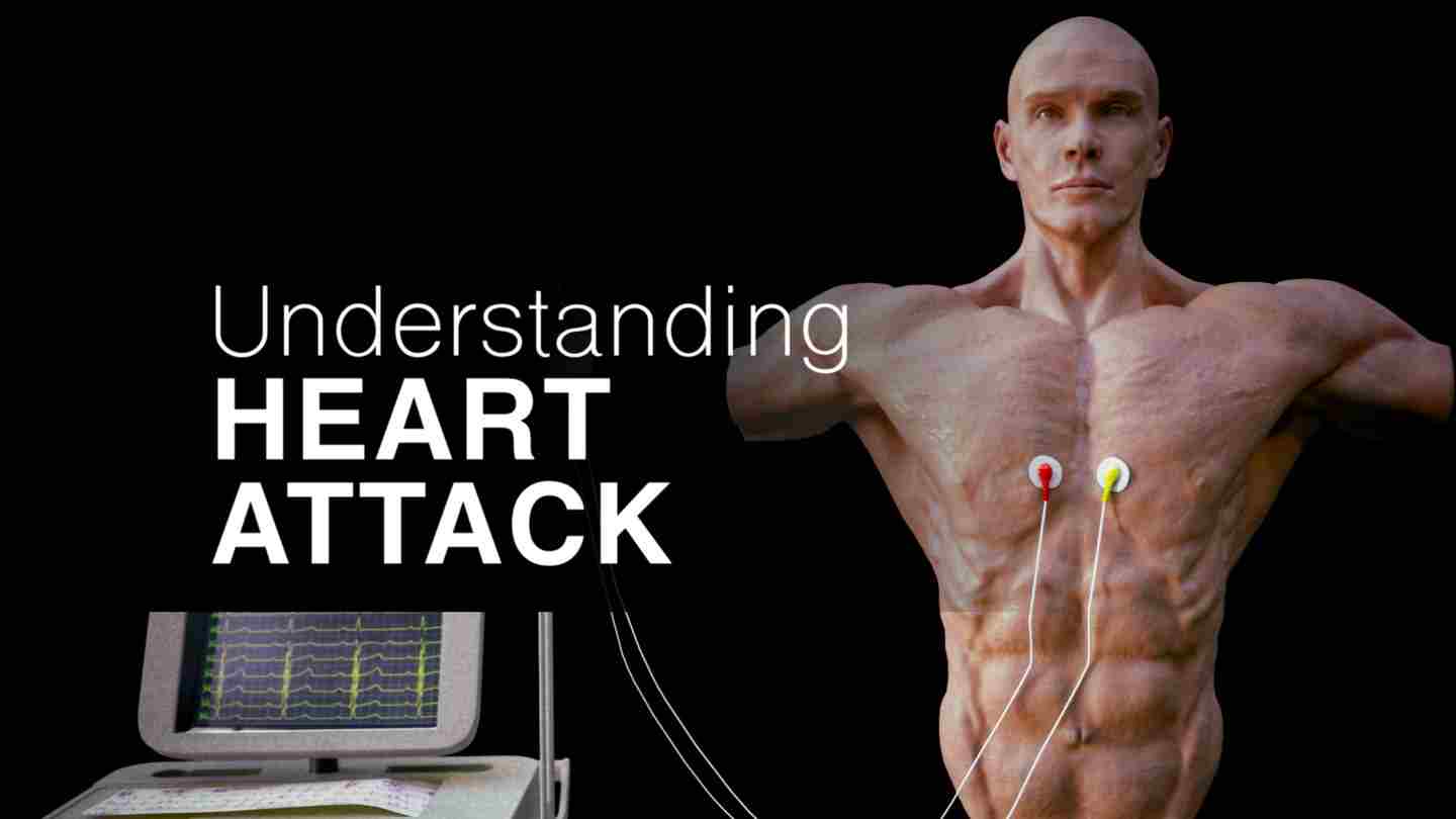 Meta Quest 游戏《了解心脏病》Understanding Heart Attack